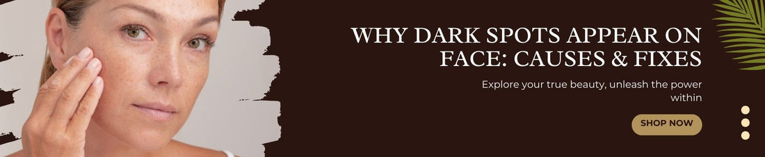 Why Dark Spots Appear On Face: Causes & Fixes