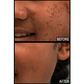 Glycolic Resurfacing Toner with Hyaluronic & Meadowsweet